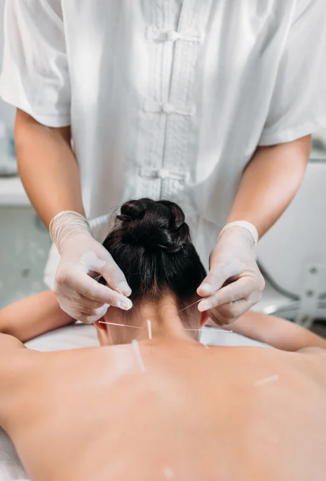 Neck-Acupuncture